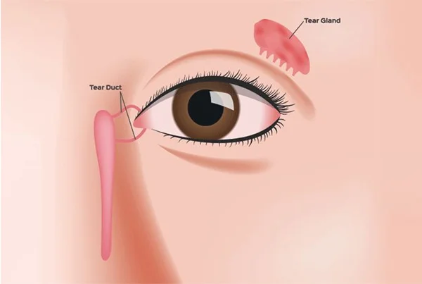 Tear Duct Problems