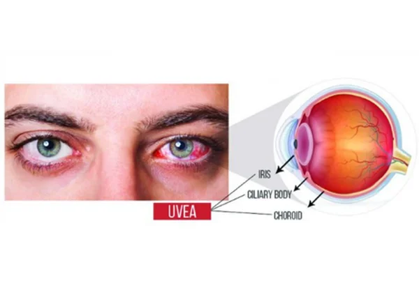 Retina and Uvea Services