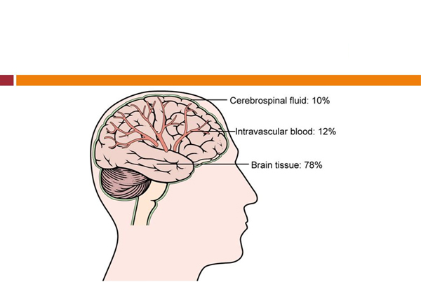 Intracranial Hypertension