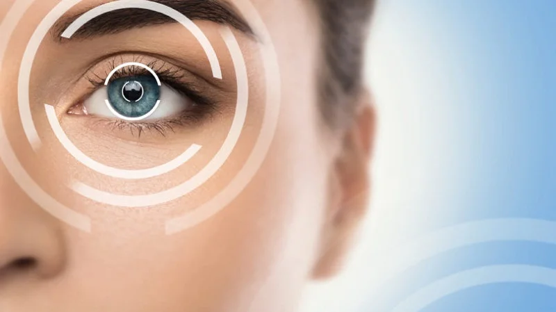 LASIK Surgery